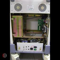 УЗИ Sonoscape SSI-5000 2