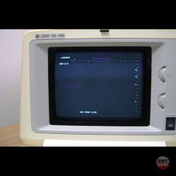 УЗИ GE Logic 100 Pro 5