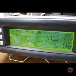 Пульсоксиметр Bionics BPM200 2