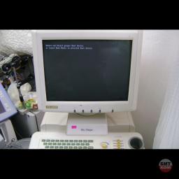 УЗИ Sonoscape SSI-5000 5