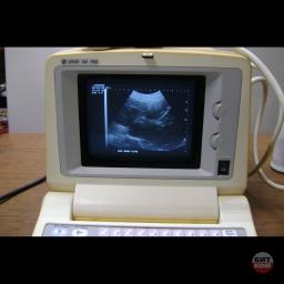УЗИ GE Logic 100 Pro 2