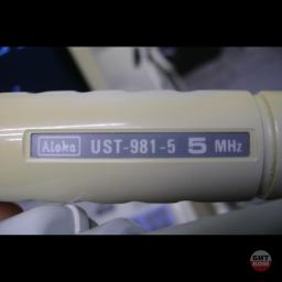 УЗИ Aloka SSD-1100 4